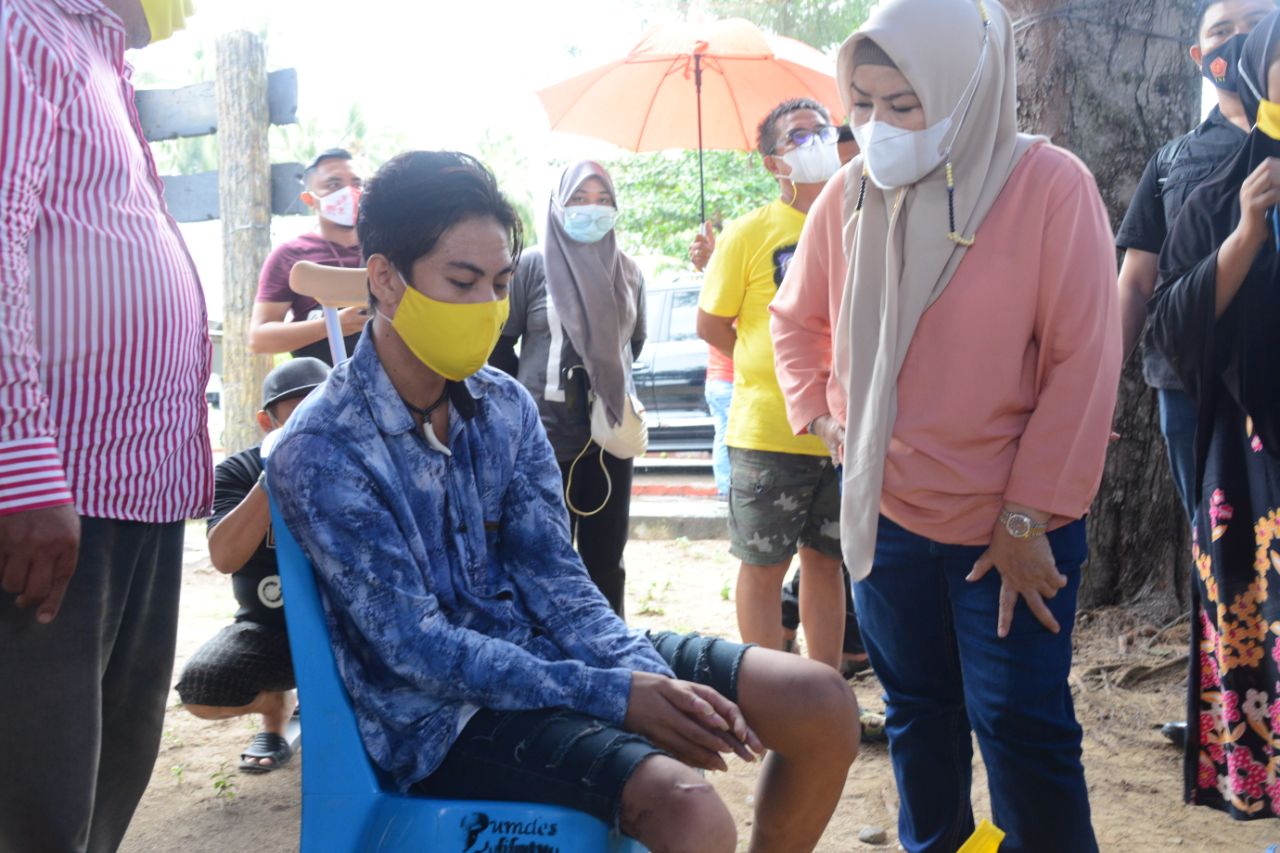  Gubernur dan Istri Bantu Kaki Palsu Remaja Disabilitas di Boalemo